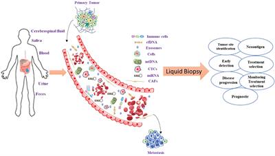 Liquid biopsy approaches and immunotherapy in colorectal cancer for precision medicine: Are we there yet?